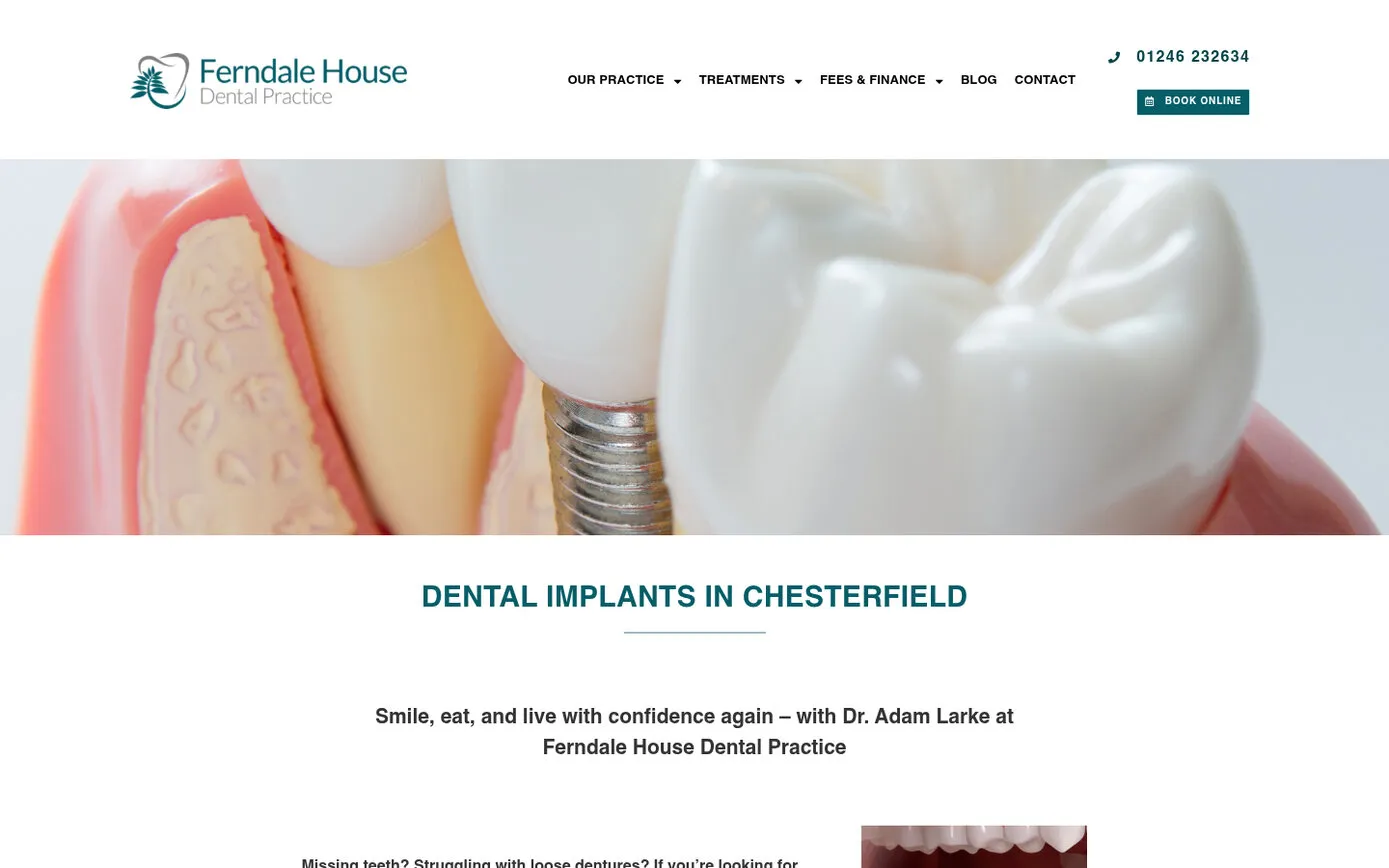The dental implants page: “Dental implants in Chesterfield” under a close-up illustration of an implant