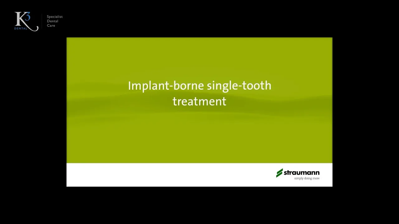 Straumann’s title card, “Implant-borne single-tooth treatment”, framed on black with a small K3 Dental logo in the corner