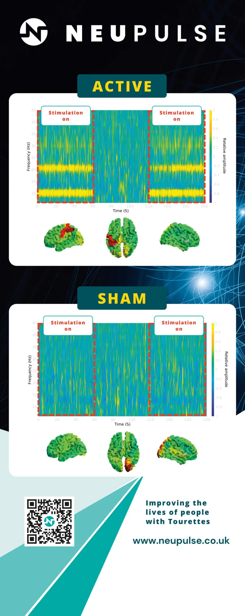 The scientific roller banner: the logo at the top, then two panels headed ACTIVE and SHAM, each with a chart of brain activity and three brain scans, and a QR code at the foot